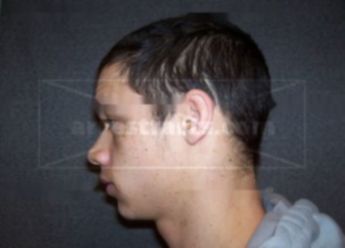 Garrett G Holmberg