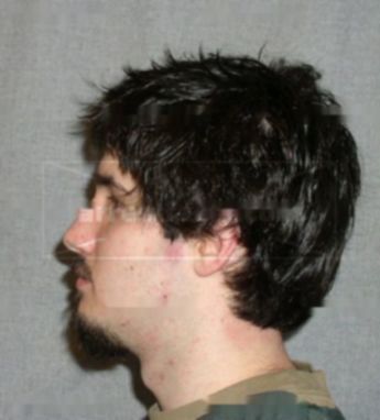 Timothy A Jacobson