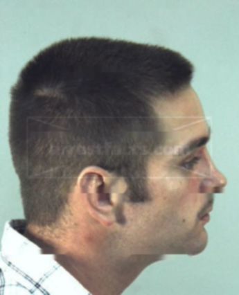 Travis L Harbison