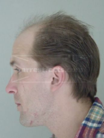 Gregory S Mikula