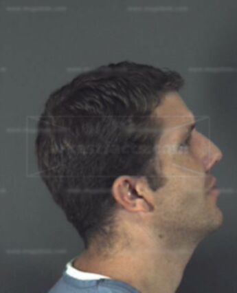 Douglas Allen Bitzer