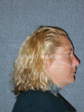 Christina J Homan