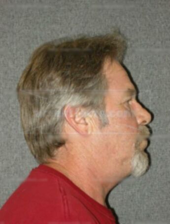 Lee E Kremsreiter