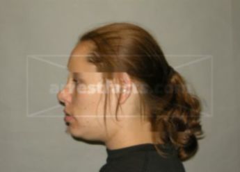 Melissa Lynn Johnson