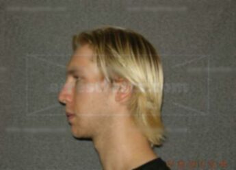 Brandon M Baringer
