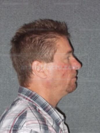 Todd Allan Phillips