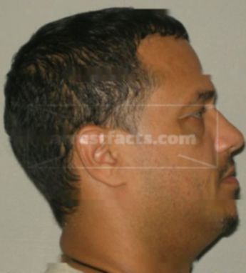 Louis Torres