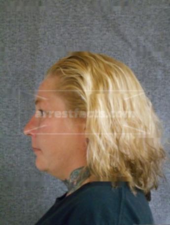 Christina J Homan