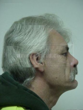 Patrick W Gibbs