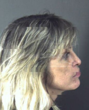 Brenda Lee Metcalfe