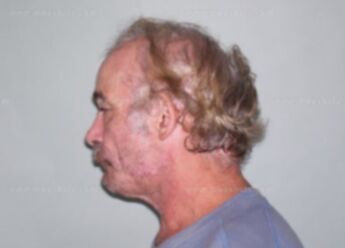 Walter L Carl
