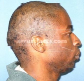 Roderick Simmons