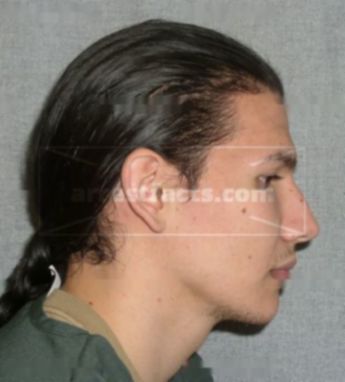Alexander S Martinez