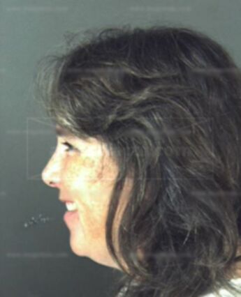 Teresa Lynne Neslein