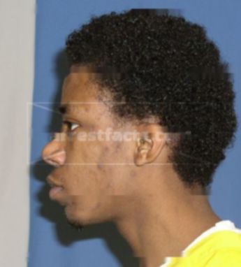 Darius Gilmore