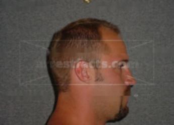 Thomas B Teske