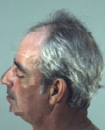 Randy Scott Dentzan