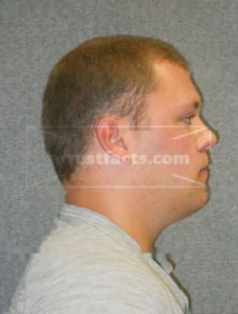 Aaron M Kolze