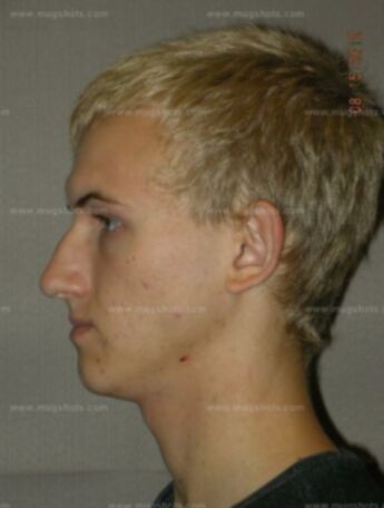 Ryan J Burnett