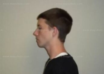 Dillon Teague