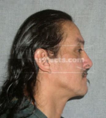 Melvin Pyatskowit