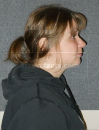 Michele J Anzalone