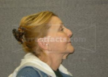 Kathleen J Tvrdik
