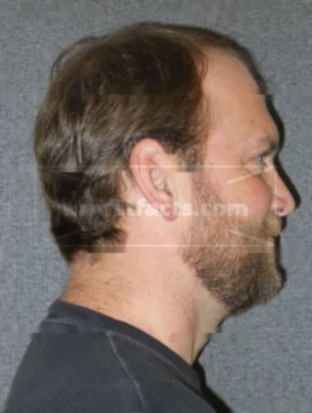Chad J Connell