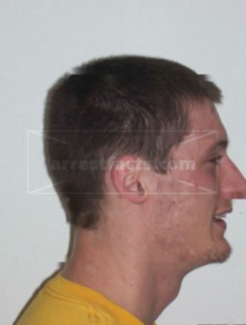 Jacob M Metz