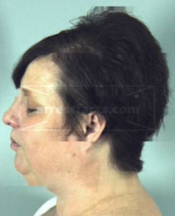 Terese Dian Easlick Sookram