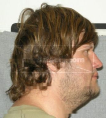 Travis Bolstad