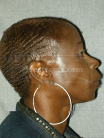 Twala L Brown