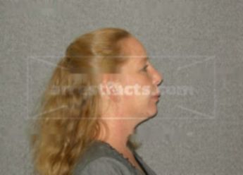 Michelle A Springston