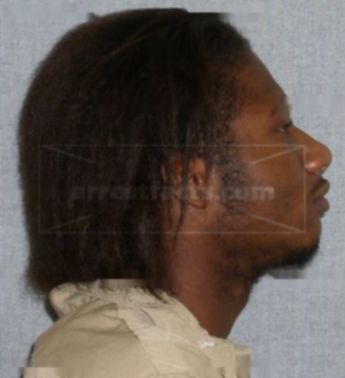 Ranard R Robinson