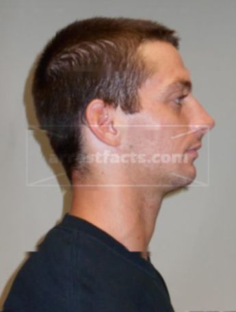 Lance R Heintz