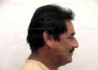 Juan Carlos Patino-Martinez