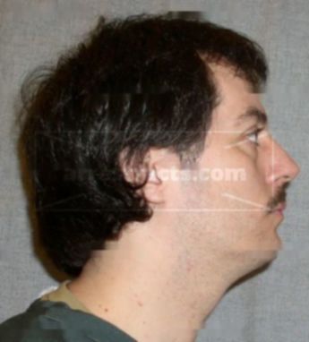 Lamar J Blindauer
