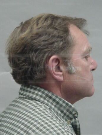 Gerald Anthony Fleischman