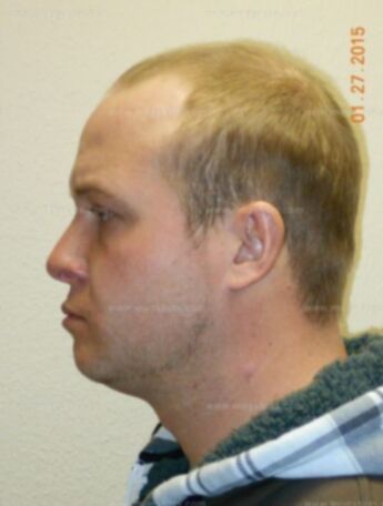 Jason J Deruyter