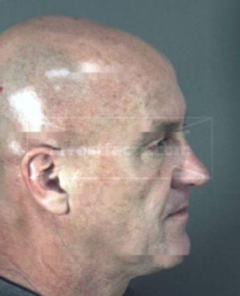 Marc Francis Techau