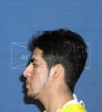Zalatiel C Gonzalez