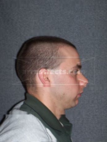 Chad W Scanlon