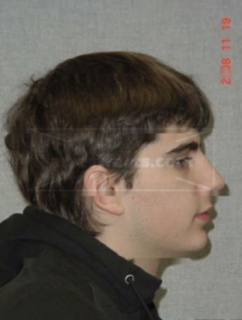 Harrison R Anderson