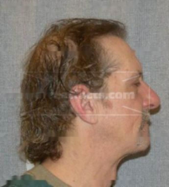 Lewis J Balthazor