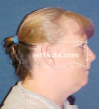 Tammy M Schortemeier