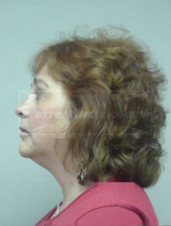 Susan M Price