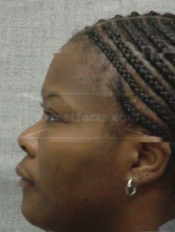 Chevette Watkins