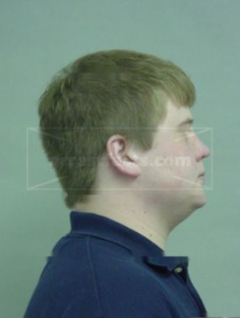 Ryan R Phillips