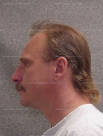 Gerald J Brummond
