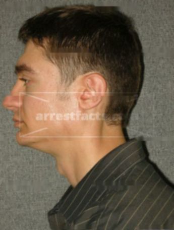 Thomas J Schrader